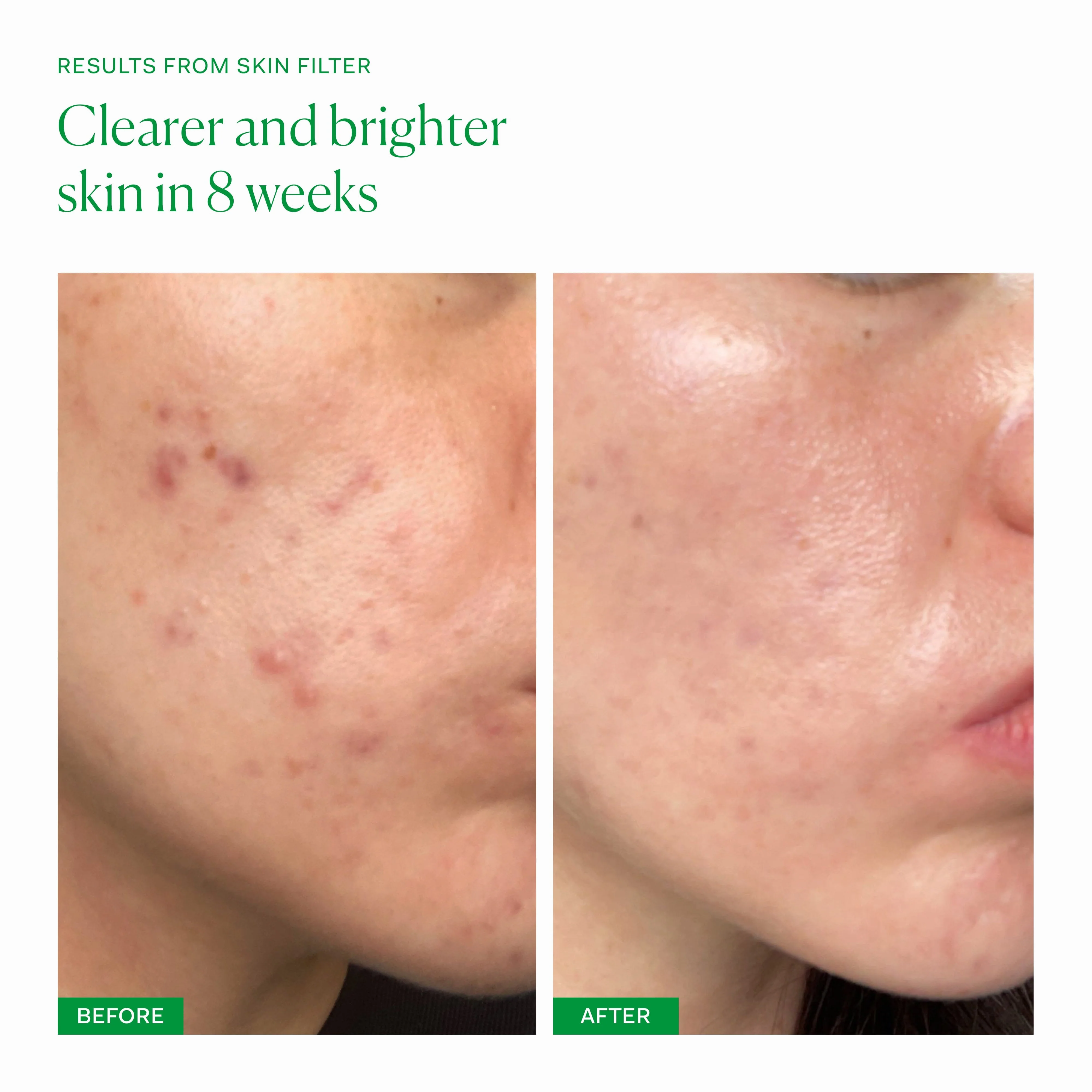 Skin Filter - Image 4