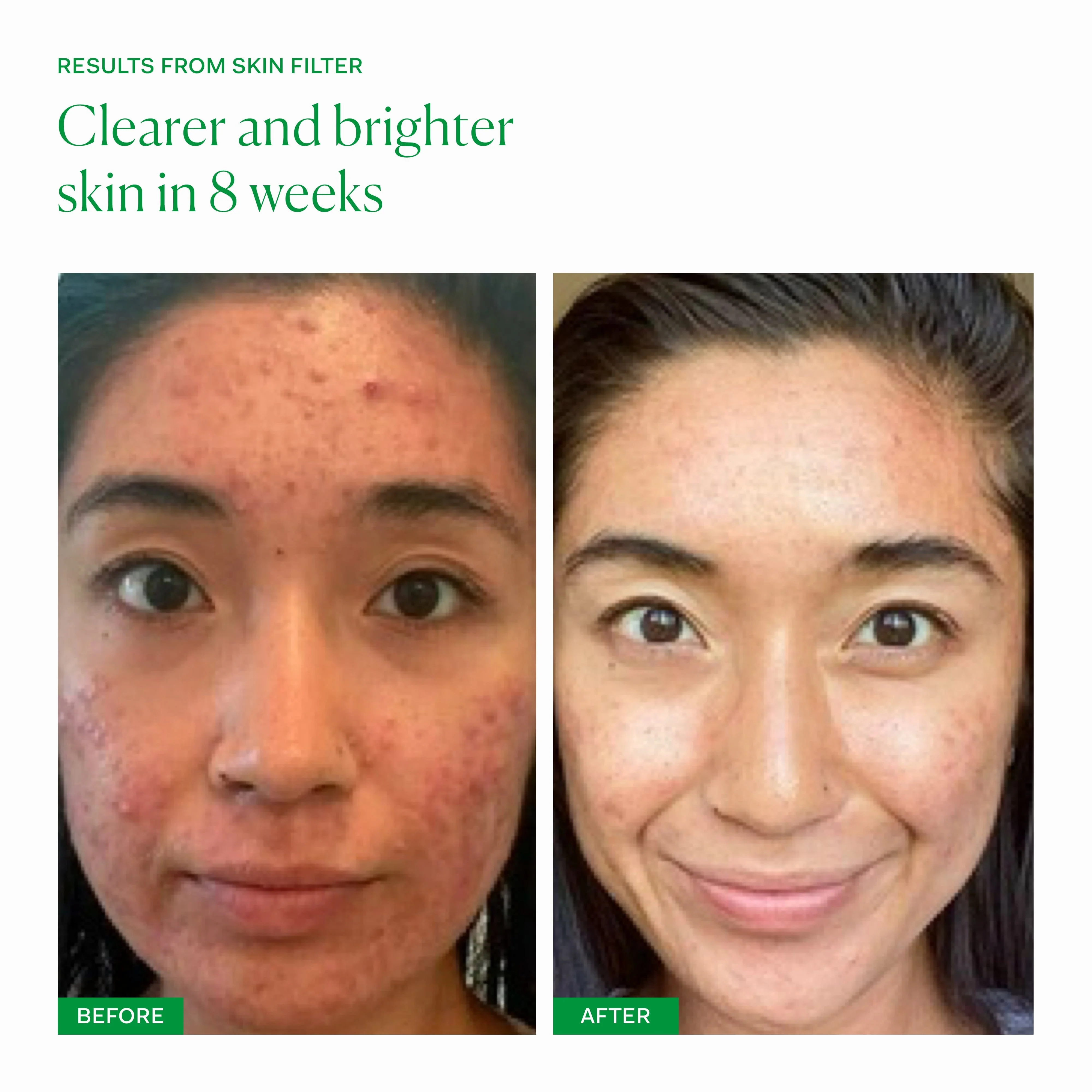 Skin Filter - Image 5