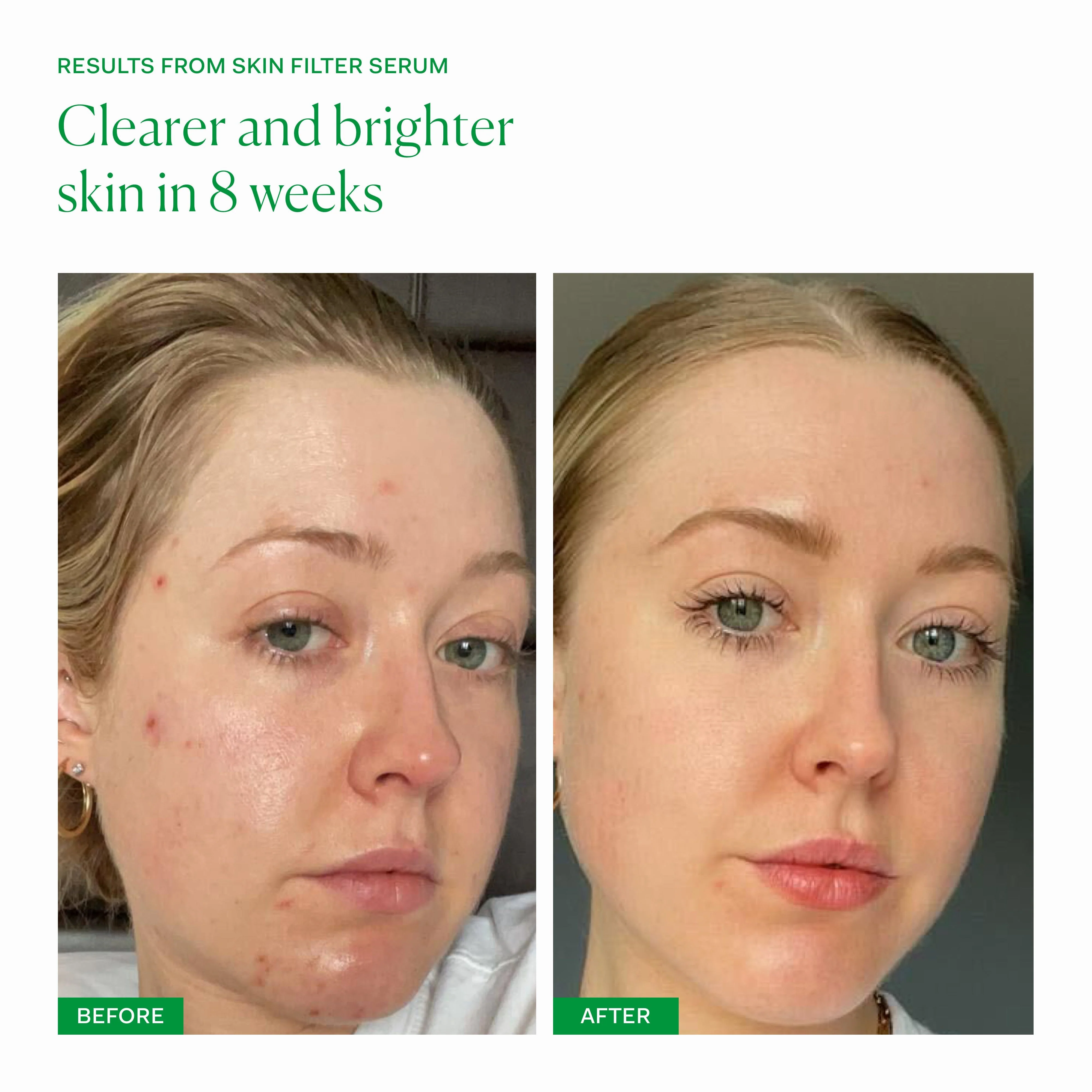 Skin Filter Serum - Image 4
